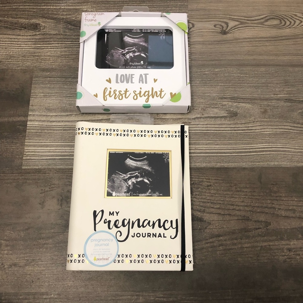 Pearhead Pregnancy Journal and Sonogram Frame Set - Cream and Black‎